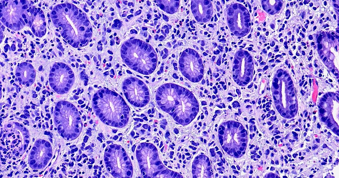 Gastrointestinal, Liver and Pancreas Pathology